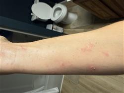 Arm.jpeg